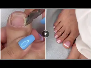 Most Satisfying Pedicure Transformation 